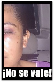 2 - 1 victima de violencia de su ex pareja