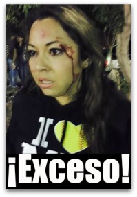 AGRESION SOFTBOL