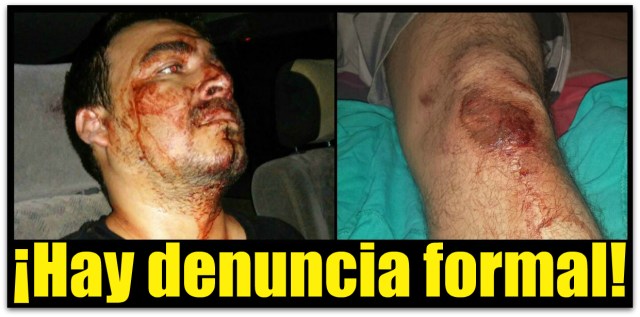1 a oscar adrian lo lesiono en pandilla