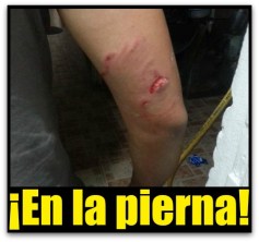 1 ataque de pitbull