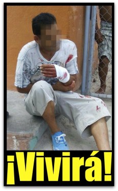 1 atacado a balazos en colonia guerrero la paz