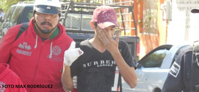 0-a-a-a-disparo-en-la-mano-derecha